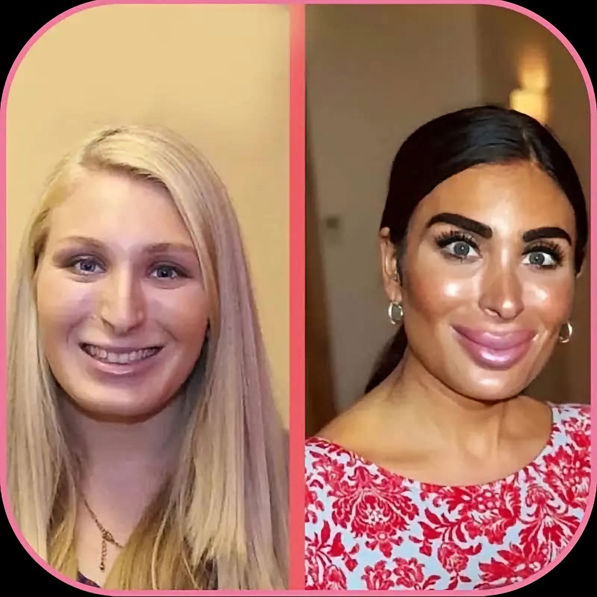 d_clhm's tweet photo. @LauraLoomer @AngieNixon Really? What the fuck? Is this what you call a Mar a Lago face? 🤔😂😂 Ugly as fuck!! https://t.co/Vry0InkEwW