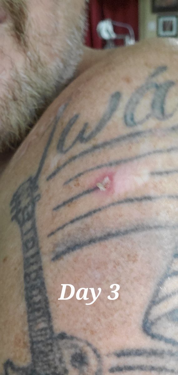 jopawo's tweet photo. I will say, it's only Day 4 using the Ivermectin and the scab is gone. That thing has had a scab on it for months. Sorry if this seems gross to you. https://t.co/4oESUwSGBx