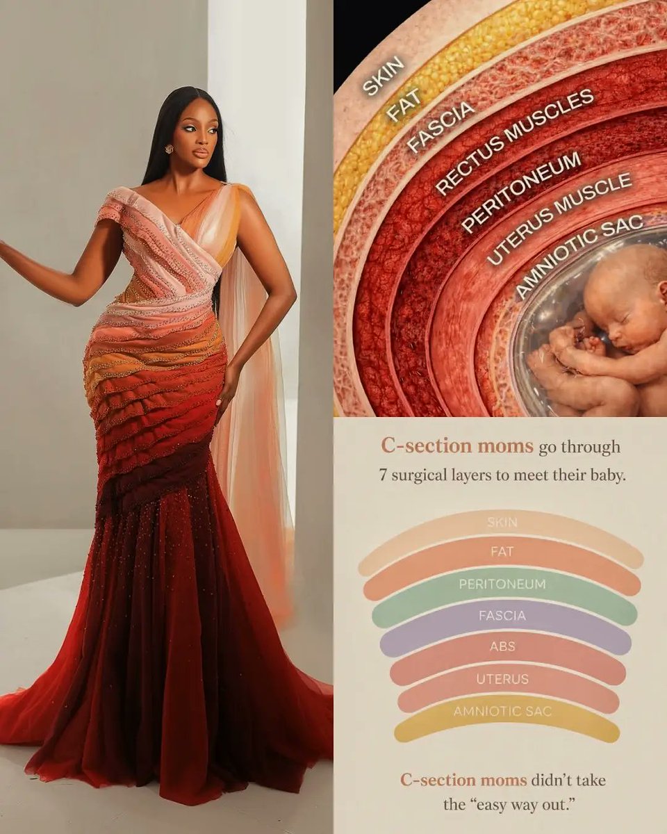 Afro_Actu's tweet photo. 🇺🇬 Miss #Uganda Trivia Elle Muhoza a sublimé Miss World 2026 avec sa robe « Layers of Life ».

Conçue par Keesha Abdallah, elle représente les 7 couches que les médecins traversent lors d’une césarienne : peau, graisse, fascia, muscles, péritoine, utérus et poche amniotique. https://t.co/8IqUqk7OxP