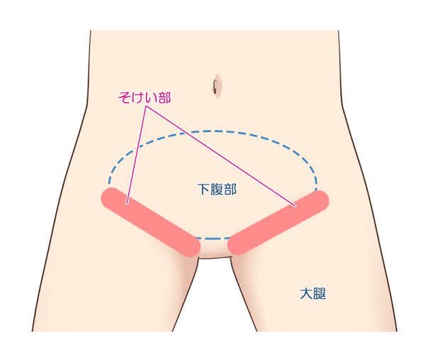 sophivora's tweet photo. 「最近物忘れが多い」それ、脳の疲れじゃなくて下腹が原因かも。

​内臓が下垂してぽっこり出ると、足の付け根にある太い血管が圧迫されて下半身の血流が滞る。

​下半身の循環が崩れると、首や脳へ届く酸素のめぐりまで一気に鈍くなります。 https://t.co/BVyO40GBnm
