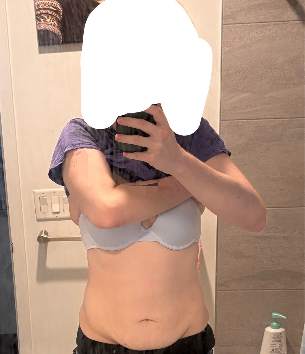 florecent_babe's tweet photo. Do I even look my bmi 😭 I’m bmi 22.2… https://t.co/LkTdVwEift