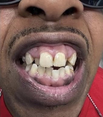 TheReal_T_Roy's tweet photo. @HoodFamousTV_ Dear Finesse, 

You’re Ugly. 😐 

Nxgga got a BBL and some veneers and still ain’t hittin on shxt 😂 Stop talking about them women you laid down with and had kids smh https://t.co/8Nf7R4KOoV