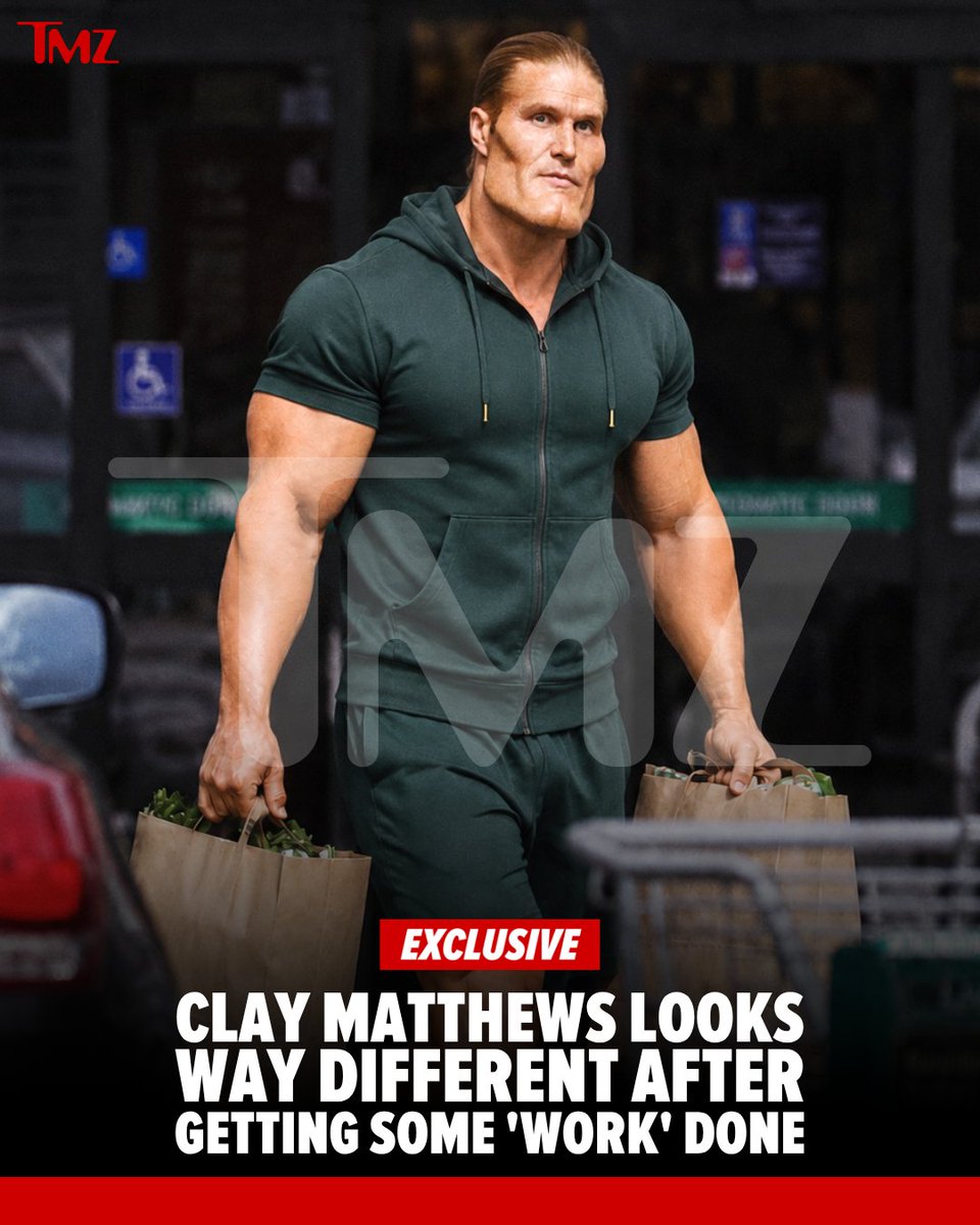 TMZ's tweet photo. Clay Matthews was spotted out grabbing groceries looking VERY different after apparently getting some work done. 👀 #ad https://t.co/8ihX46BSAl