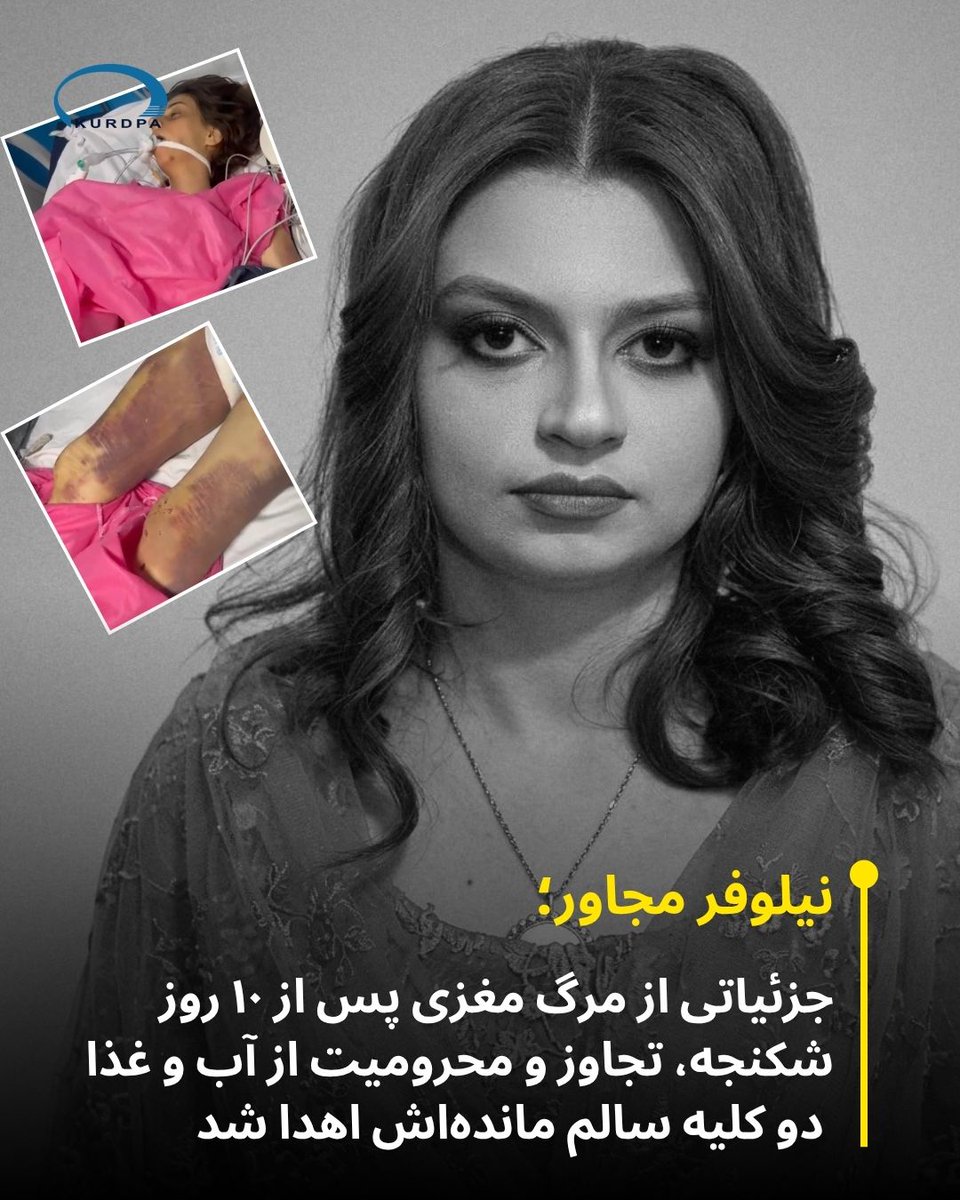 kurdpa_farsi's tweet photo. نیلوفر مجاور؛
جزئیاتی از مرگ مغزی پس از ۱۰ روز شکنجه، تجاوز و محرومیت از آب و غذا
 دو کلیه سالم‌ مانده‌اش اهدا شد
 
۱۳ شهریور ۱۴۰۵؛ «نیلوفر مجاور»، دختر ۲۷ ساله اهل پیرانشهر، که به مدت ۱۰ روز از سوی فردی پس از فریب، در مکانی نامشخص و در شرایط غیرانسانی نگهداری و به‌شدت هدف خشونت، شکنجه و تجاوز جنسی و جسمی و محرومیت از آب و غذا قرار گرفته بود، با مرگ مغزی روبه‌رو شد و پس از چند روز بستری شدن در بیمارستان، خانواده با اهدای دو کلیه او که تنها اعضای سالم باقی‌مانده بدنش بودند، موافقت کردند و او جانش را از دست داد.

خانواده علیه فردی به نام «سید عزت‌الدین سیدطاهری» که از وضعیت آسیب‌پذیر نیلوفر سوءاستفاده کرده و به طرز هولناکی او را شکنجه و مورد تجاوز قرار داده بود، شکایت کرده‌اند؛ با این حال، این فرد هنوز بازداشت نشده است.

https://t.co/84JMMuPBAY