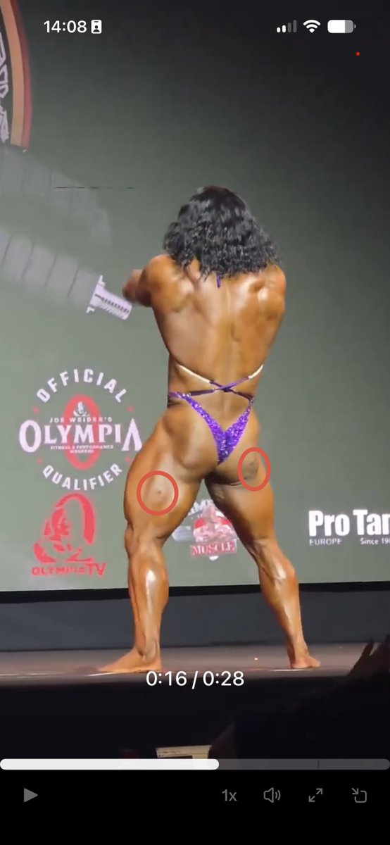 I_8NTPLYN's tweet photo. @MbarkCherguia Common injection points for steroid use. 💉😅. I’m sure everyone knows that it’s improbable for her to achieve this physique without juice. 🏋🏾‍♀️ https://t.co/CIRUtBYEkX