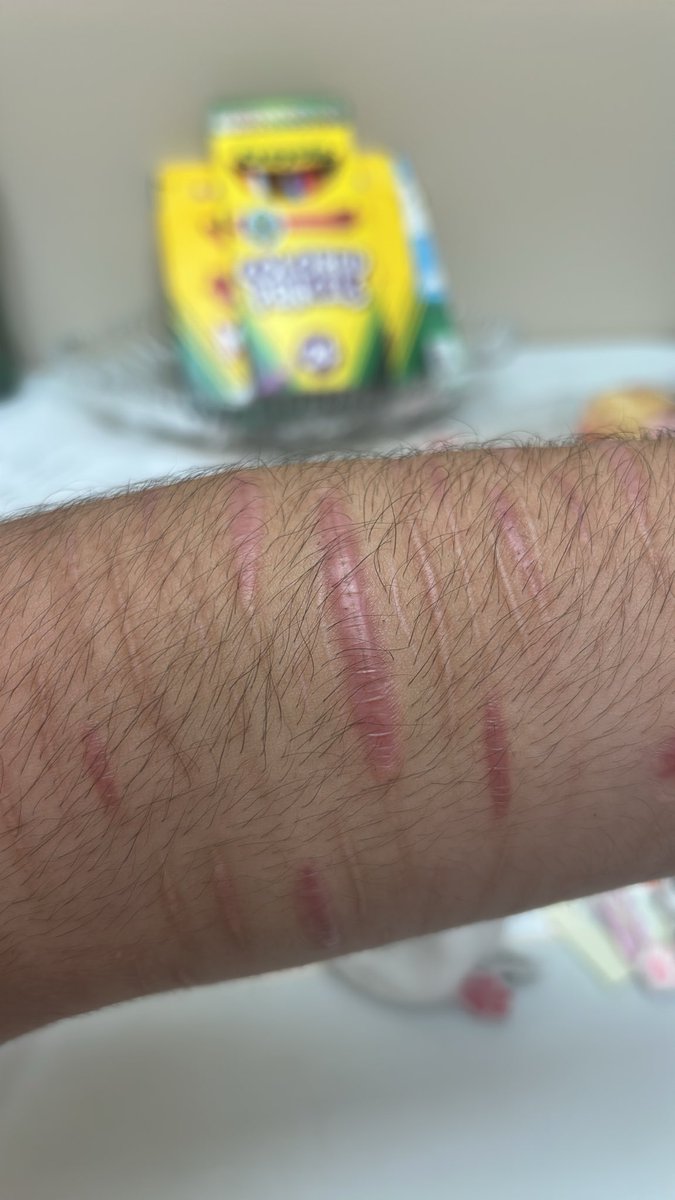 camelliacookiex's tweet photo. i hate how u can see a line in my scars lowk.,, like its cool and all but i hate it kinda.,,,, https://t.co/4qq7OAsy2i