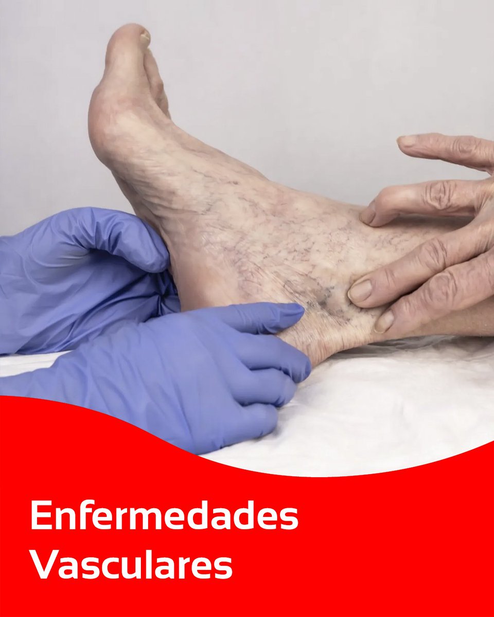MedicVascular's tweet photo. La mejor atención especializada en padecimientos vasculares.  

#MédicaVascular #EnfermedadesVasculares https://t.co/ge4iAGGaNh