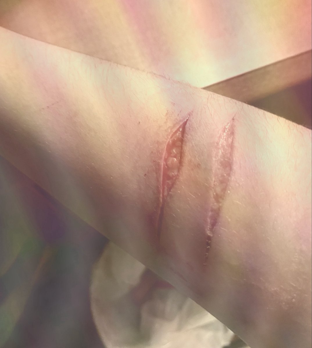 oliveeeax's tweet photo. 🫘 + healing 🫘 
ALL FAKE sfx makeup AI GENERATED sfx
#slittwt #ouchietwt #988twt #shrtwt https://t.co/z6NNRztMfb