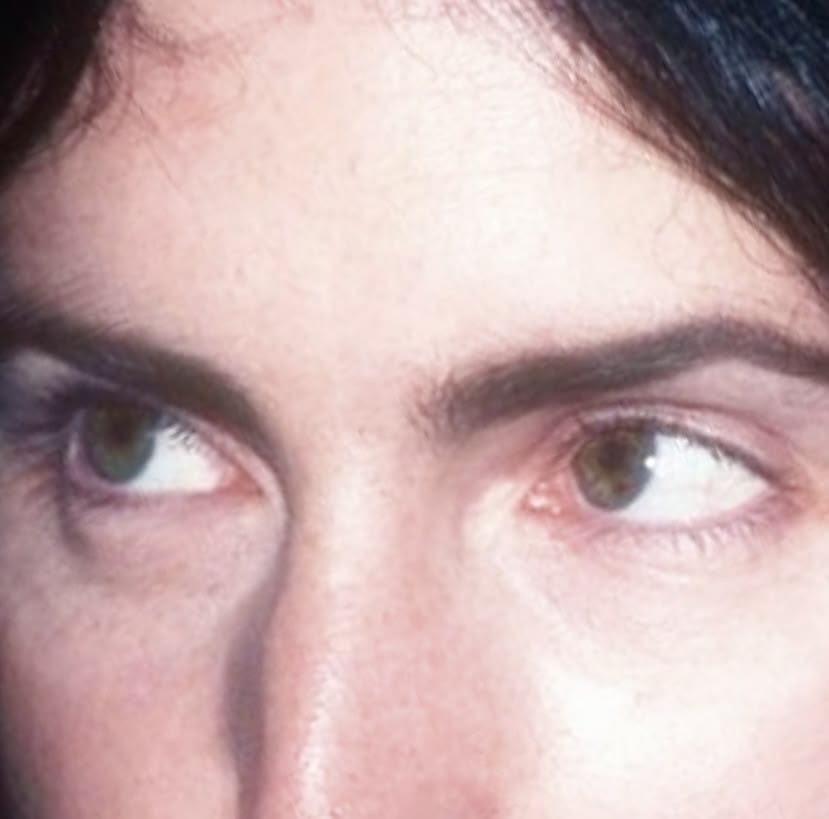 trentrezzie's tweet photo. Trent’s eye freckle on full display https://t.co/7tjuoO29m8
