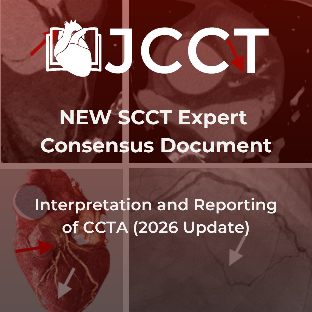 Heart_SCCT's tweet photo. "The guideline was developed by 14 international cardiac CT experts using a modified Delphi process w/ defined thresholds for consensus, lending the recommendations a transparent, reproducible level of evidence &amp; expert agreement." @cardioQT 
@journalCCT | https://t.co/UEDRwaVK9t https://t.co/HhJgIgOrrb