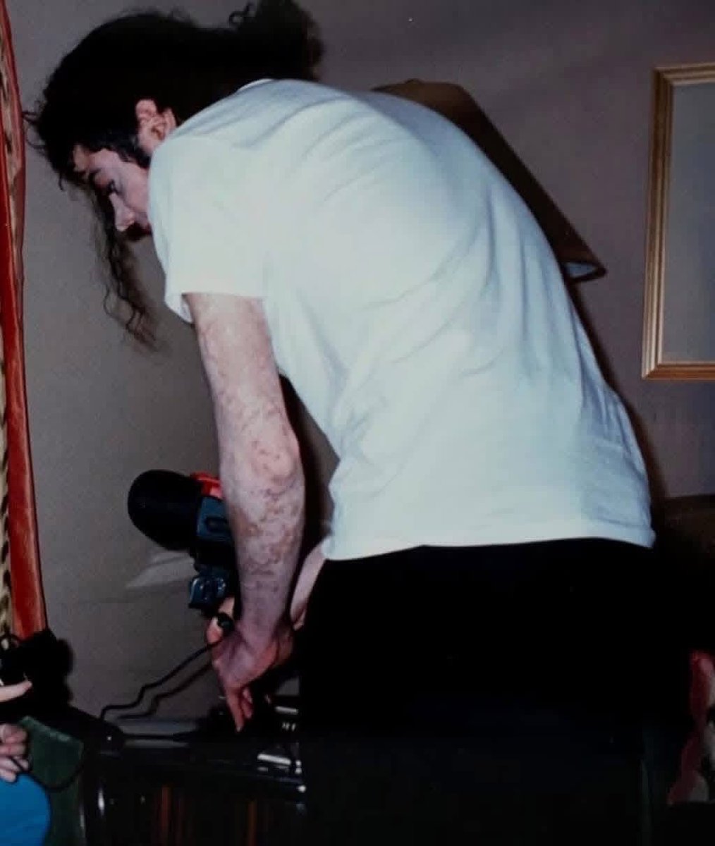 jacksncntrl's tweet photo. @haterkid1 @michaeljackson Michael had universal vitiligo , this is is why 95% of his body was covered in white patches , He was &amp; is black, period. https://t.co/HG0E4Wo9jM