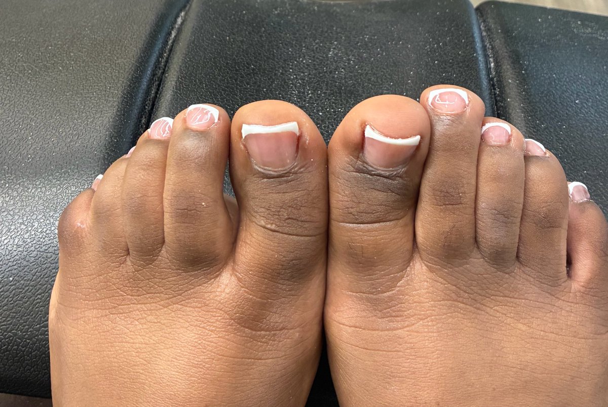 solebyM's tweet photo. I hope you don’t mind my special toe 🥺
#footfetısh #webbedtoe #frenchtip #pedicure https://t.co/ryeLHgWSF3