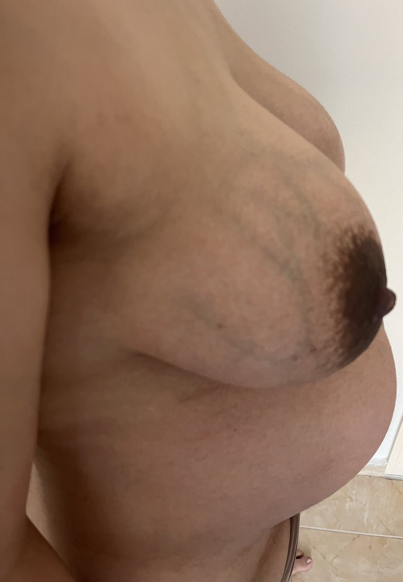 twcb2025's tweet photo. 血管 https://t.co/qusxzRy2Dq