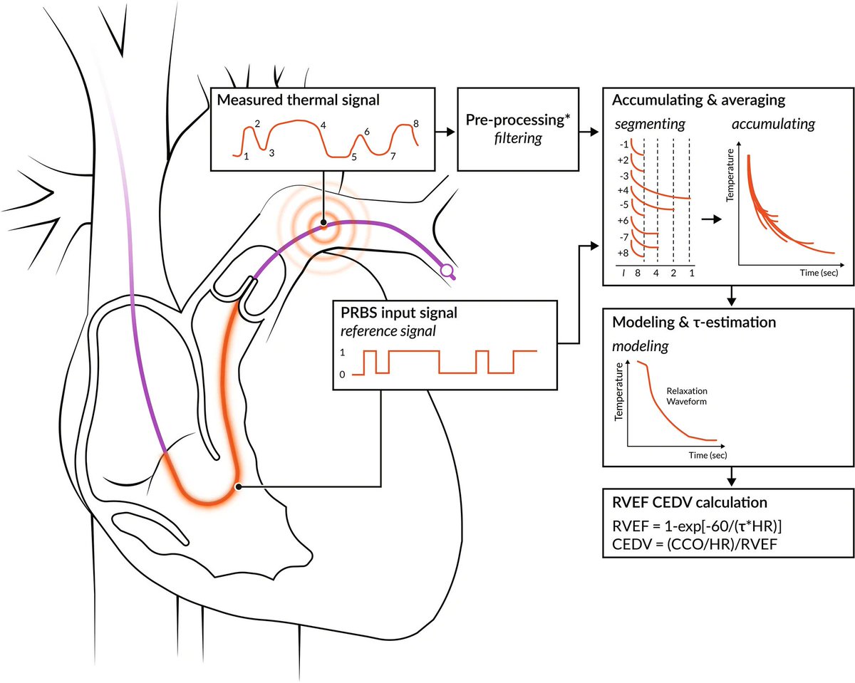 CritCareReviews's tweet photo. Today's Paper of the Day is:

The contemporary pulmonary artery catheter. Part 2: measurements, limitations, and clinical applications

https://t.co/JKgcYjlUQ5

Join us to read 1 paper per day and stay up-to-date as we cover the spectrum of critical care across 2026 https://t.co/IwcOaxcaWo