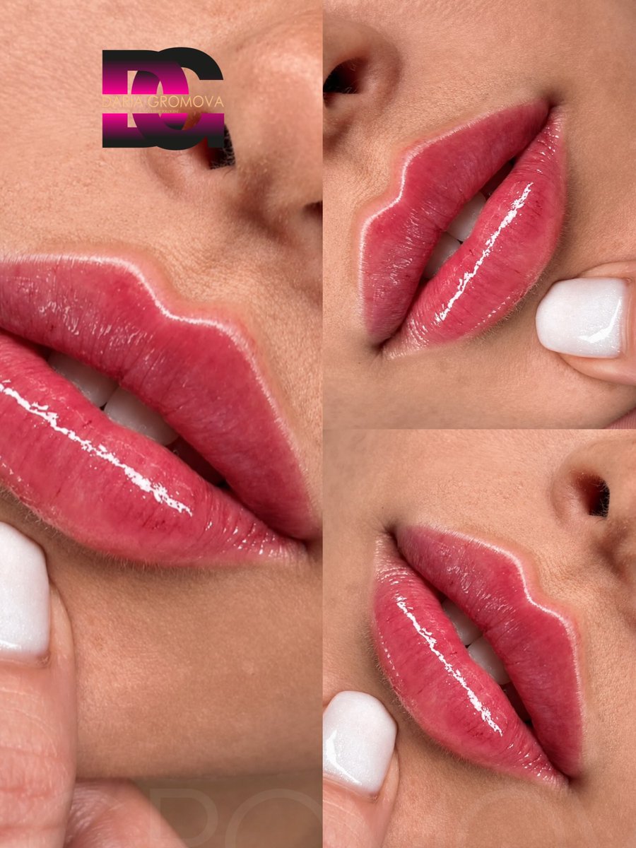 TequilaByan's tweet photo. Time takes its toll: volume fades, contours blur, and the upper lip seems to disappear. Russian Lips enhances Cupid’s bow, symmetry, and height for defined, elegant, naturally balanced lips—no surgery needed. https://t.co/8iQFMcz5Lk