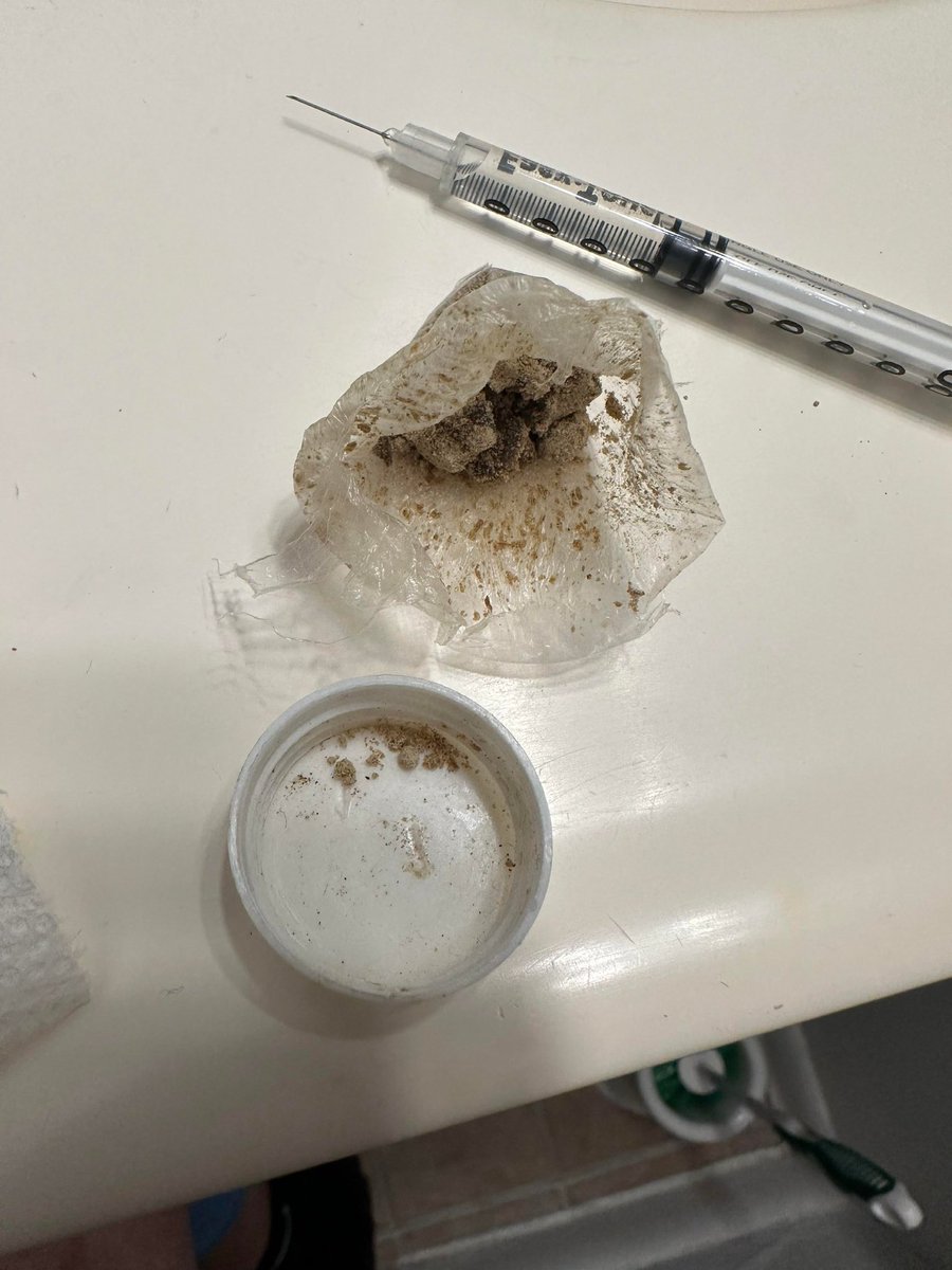 rig5634's tweet photo. Successfully tapered!! But riddle me this  #drugtwt #shedtwt https://t.co/EPr83ugyN0