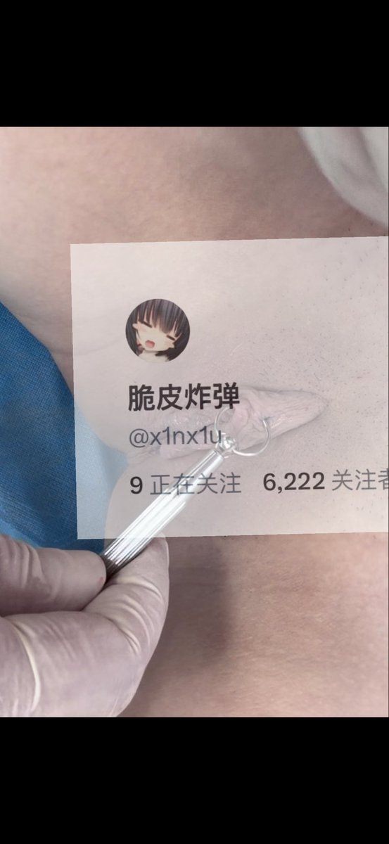 x1nx1u's tweet photo. #阴环 #阴蒂环 #穿孔
钱到位可以让我做任何事哟～ https://t.co/wTBdR0eTlZ