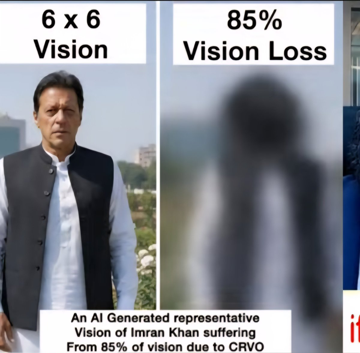 ShehnazB2IK92's tweet photo. Don't forget Imran Khan went from full vision to 85% vision loss & we don't know if it has got any better & we did nothing about it, he was our red line, let that sink in
#FreeImranKhan
#StopRiskingImranKhansLife
#27SeptLongMarch https://t.co/3hqFp99mzA