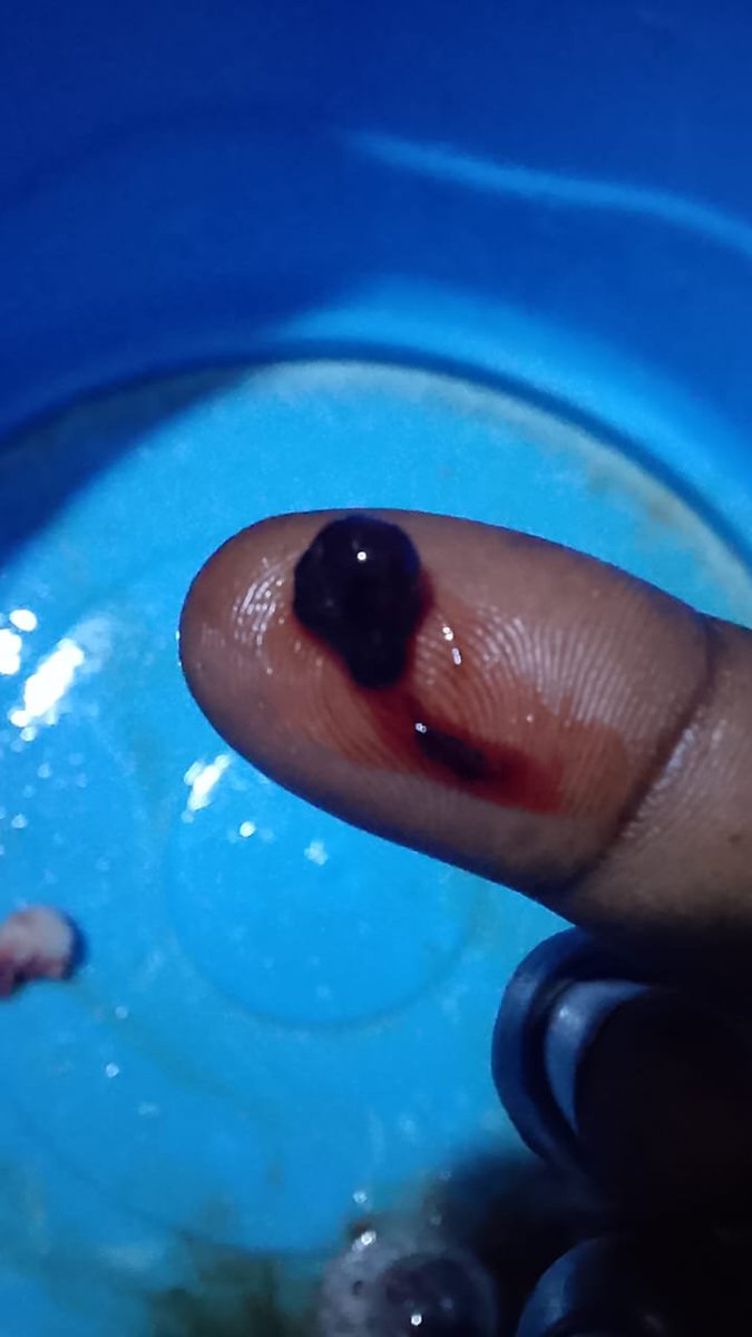 Mikae__l's tweet photo. We don't know what this is but hope she will be ok https://t.co/BCsCzQhH9R