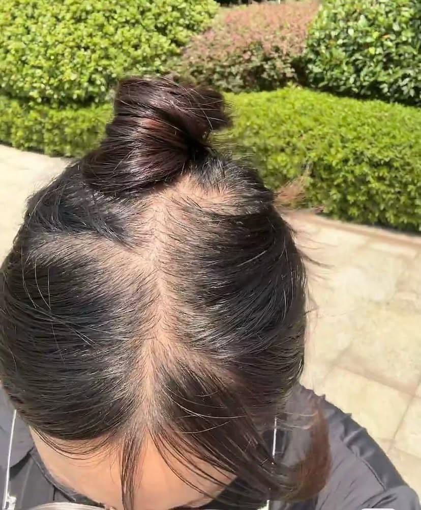 aeebkk's tweet photo. Mbak-mbak Sephora yg dulu nyaranin, semoga minuman kamu gak pernah kebanyakan gula😭
Makasi ya skrng rambut ku gak pitak lagi, lebih bervolume dan lebat gak gampang lepek🥲￼ https://t.co/ANQEr5NGAh