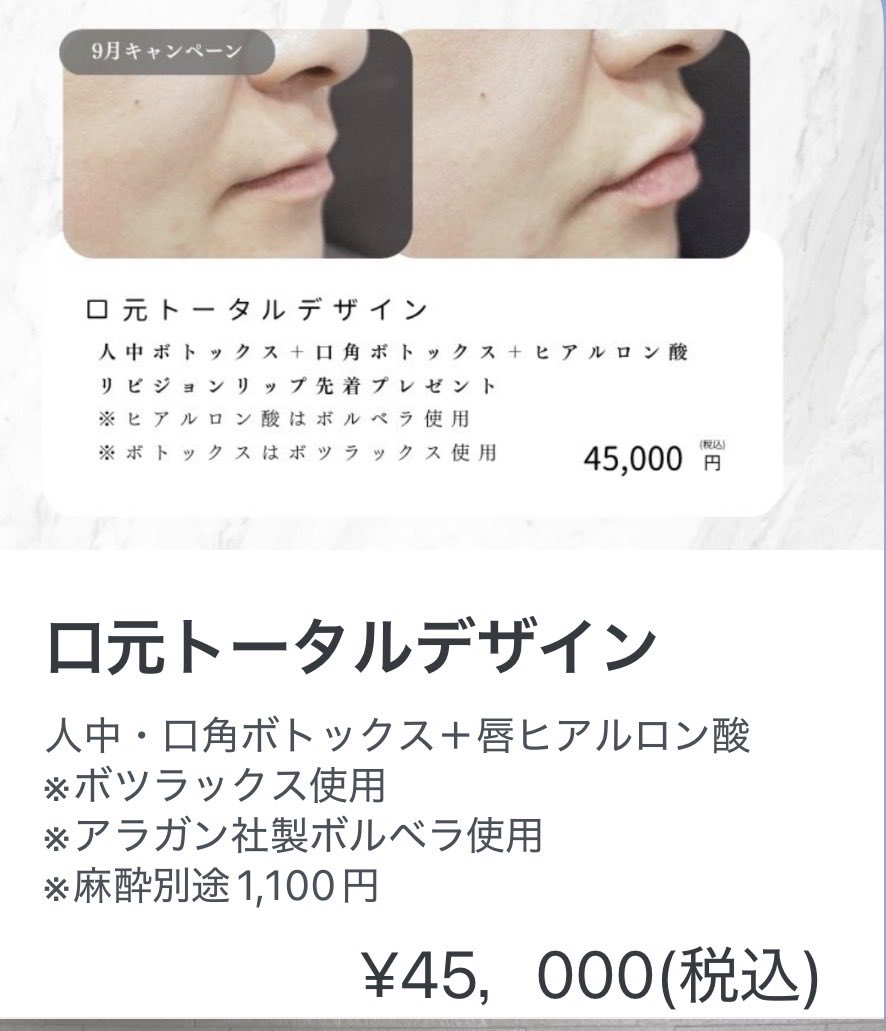radias_cl's tweet photo. こんにちは！本日は院長出勤日となっております！デザインも医師と相談して決める事が出来るので、ぜひこの機会にご利用くださいませ👩🏻‍⚕️✨ https://t.co/HXau6EjAkY