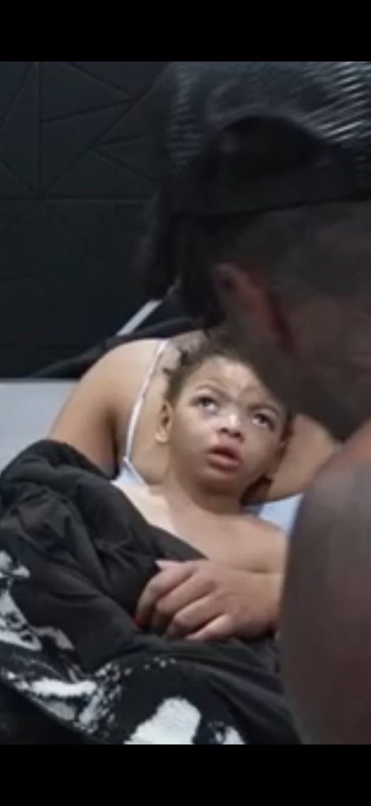ishowkzee's tweet photo. This is what a diet of Percocet and Backwoods during pregnancy does to your kid 🤦 https://t.co/t9w7dOYVkw