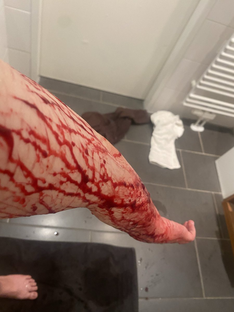 pleiadesbackup's tweet photo. Sesh during attempt 

ALL FAKE/SFX MAKEUP + AI https://t.co/Z97JI0viD8