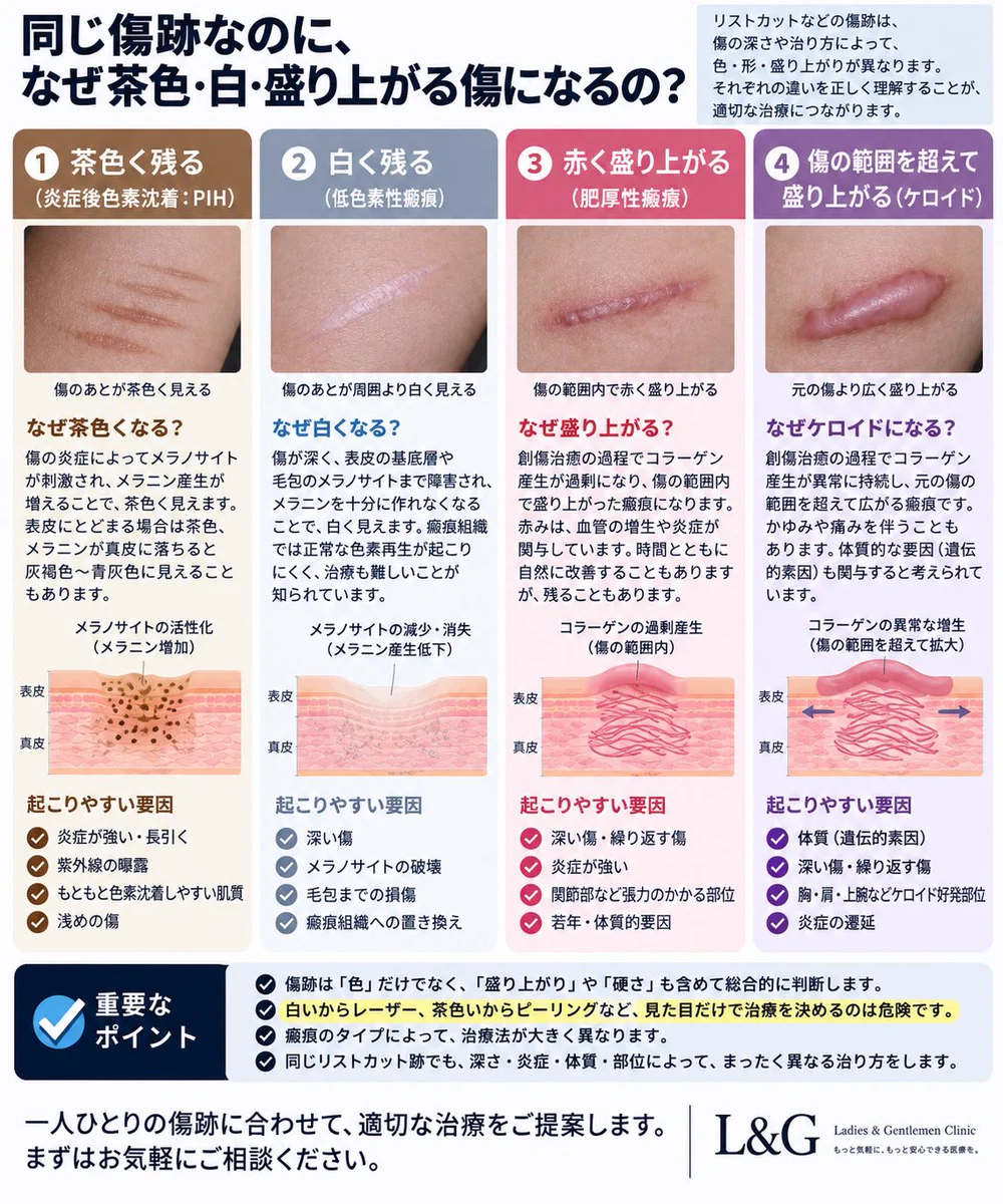 ニキビ跡治療】今井一臣 on X: 