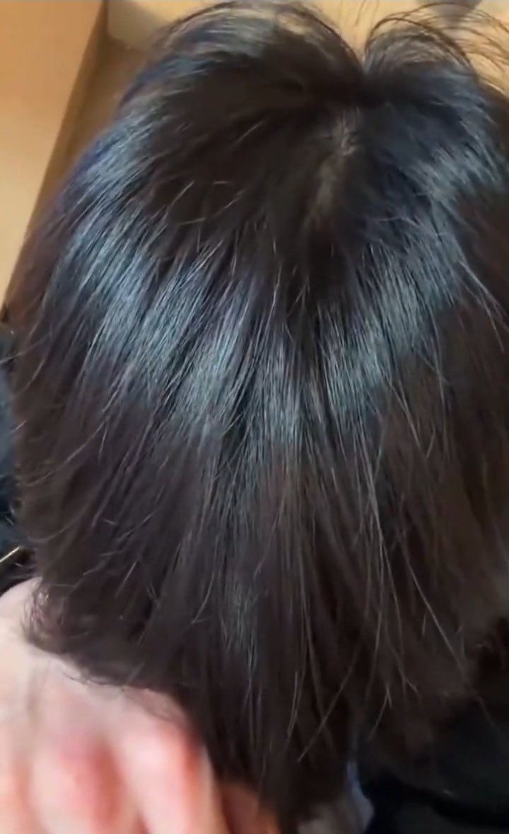 bbtan137's tweet photo. @bminejm_ @Jkooksin Jungkook having a full healthy head of hair while jimin’s hairline is receding and needs to book a flight to turkey, I know you’re mad 😭😭😭😭 talking about getting mogged like it wasn’t Jimin that was dragged to filth for looking ugly as fuck as his own event LMAOOOOOO https://t.co/VZFhG9uJJZ