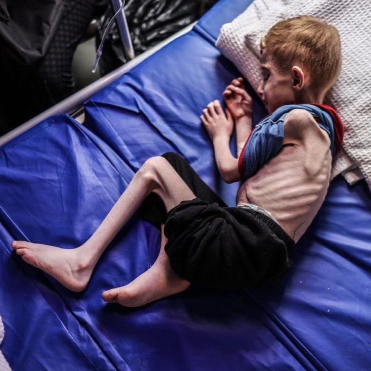New_ManNow's tweet photo. @hippyygoat #ChildrenInGaza
#GazaGenocide
#IsraelExposed
#EndOccupation https://t.co/hW3eSwLi2S