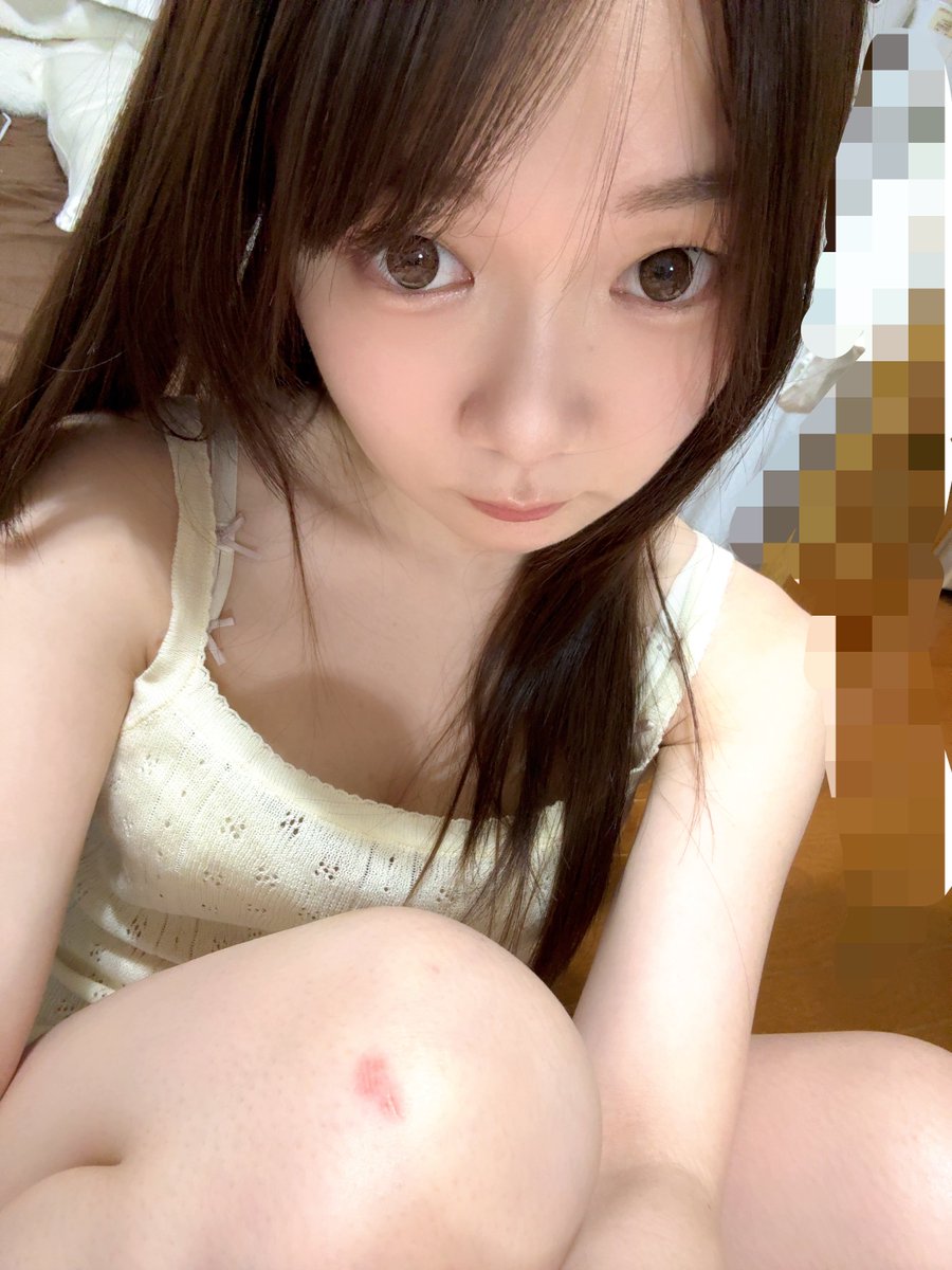mayoke__yuki2's tweet photo. 膝怪我した😢 https://t.co/FakGuVeIR8