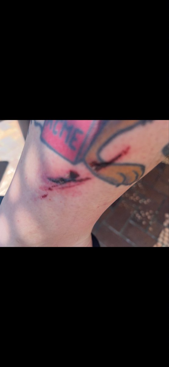 cryostructure's tweet photo. @ZachARiah1028 @ShawnRyan762 It got flagged for gore, but it did happen. Here are pics. https://t.co/DJkyZjHtVF