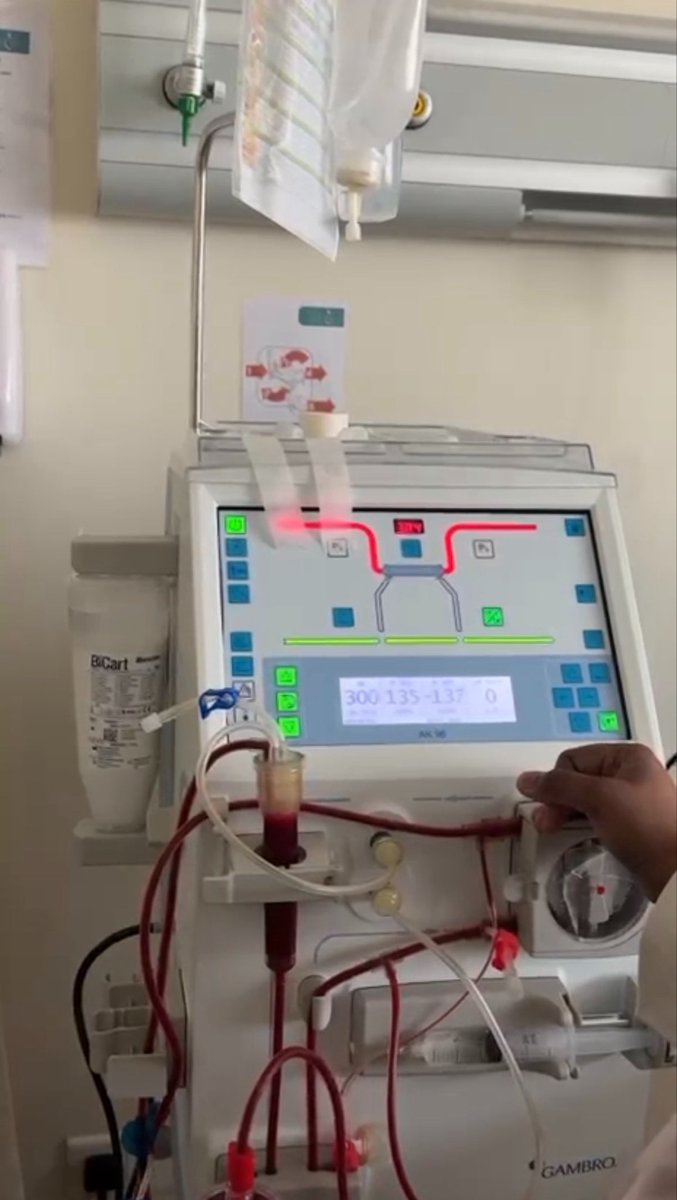 ayataltt's tweet photo. Had a great time today , learned a lot about Dialysis 🏥💉 https://t.co/GXd5P0oYKf