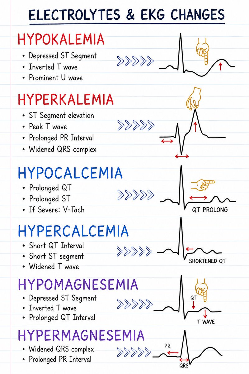 doctorinstaha's tweet photo. Electrolytes and ECG changes.
#Electrolytes #ECG #ECGChanges #ElectrolyteImbalance #Cardiology #InternalMedicine #MedicalEducation #MedicalStudents #DoctorInsta #Medicine #ClinicalMedicine #ECGLearning https://t.co/rCfsx3GxqS