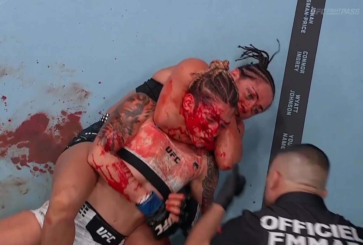pelunaton's tweet photo. DAMN 

#UFCParis https://t.co/1cRyvy6Ahq