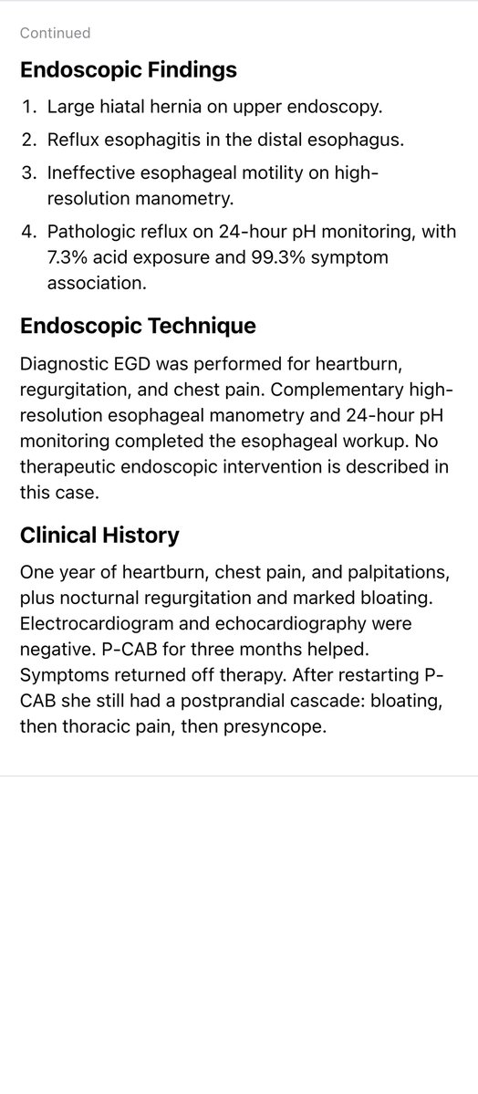 EndoCollabcom's tweet photo. 26-year-old woman. Year of heartburn, chest pain, palpitations, and a meal-linked cascade to presyncope. EKG and echo negative. Large hernia, reflux esophagitis, IEM, pathologic pH. Roemheld: GI driver, cardiac-like symptoms, exclusion diagnosis. https://t.co/TsKLolplB4