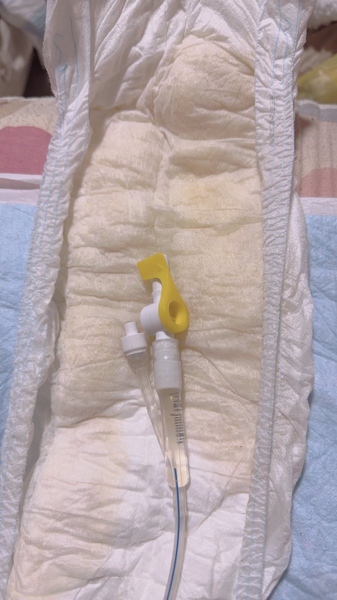 cathetersenyou's tweet photo. 寝てる間垂れ流しておいたおねしょ(？)パッドとカテーテル https://t.co/81p86CHWdU