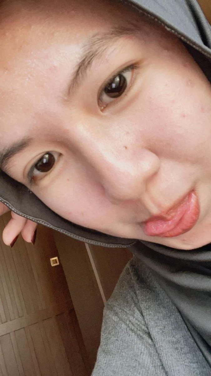 RenyRiniy's tweet photo. ih cantik
https://t.co/ZzKknh1KVY https://t.co/JIkOEGBDKU