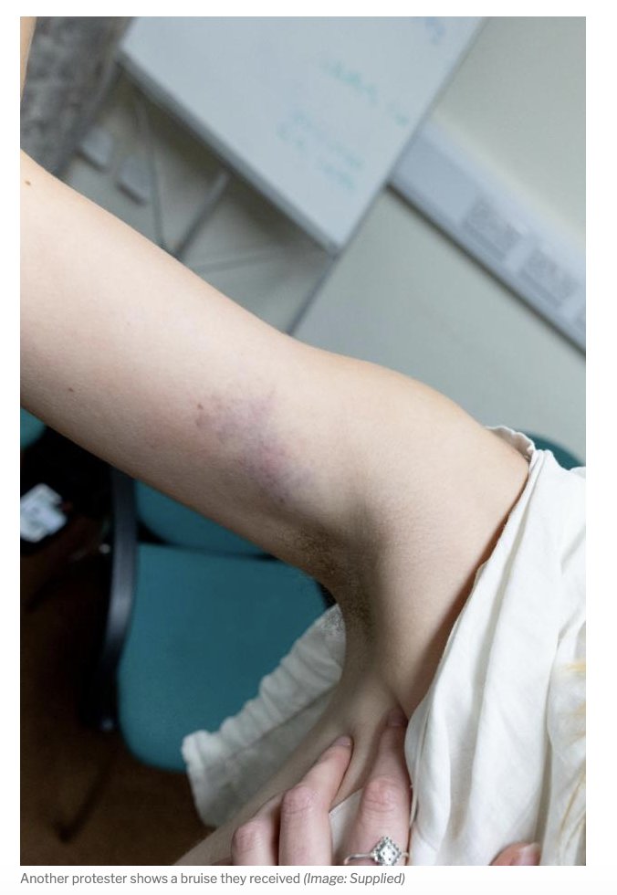 alexander_minh's tweet photo. The National has spoken to some of the protesters who were assaulted at the Reform conference

https://t.co/EX4sRYfTjR https://t.co/6Zk7DGoMF7