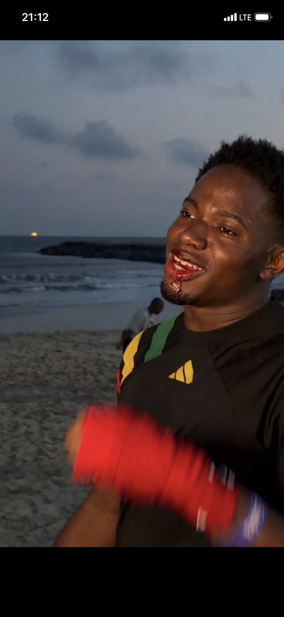 mustycrypto58's tweet photo. @ahmedxm01 don finish dis guy😂one punch got bleeding sorry @Habbyforex_ https://t.co/r96uZD3BiW
