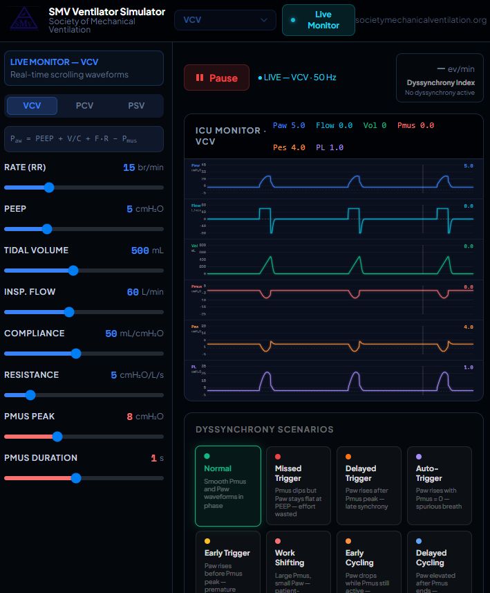 OfVentilation's tweet photo. The new "Vento" Simulator is here
https://t.co/Dw4u64UF8E 

Any suggestions for improvements are welcomed https://t.co/p47stRjbVX