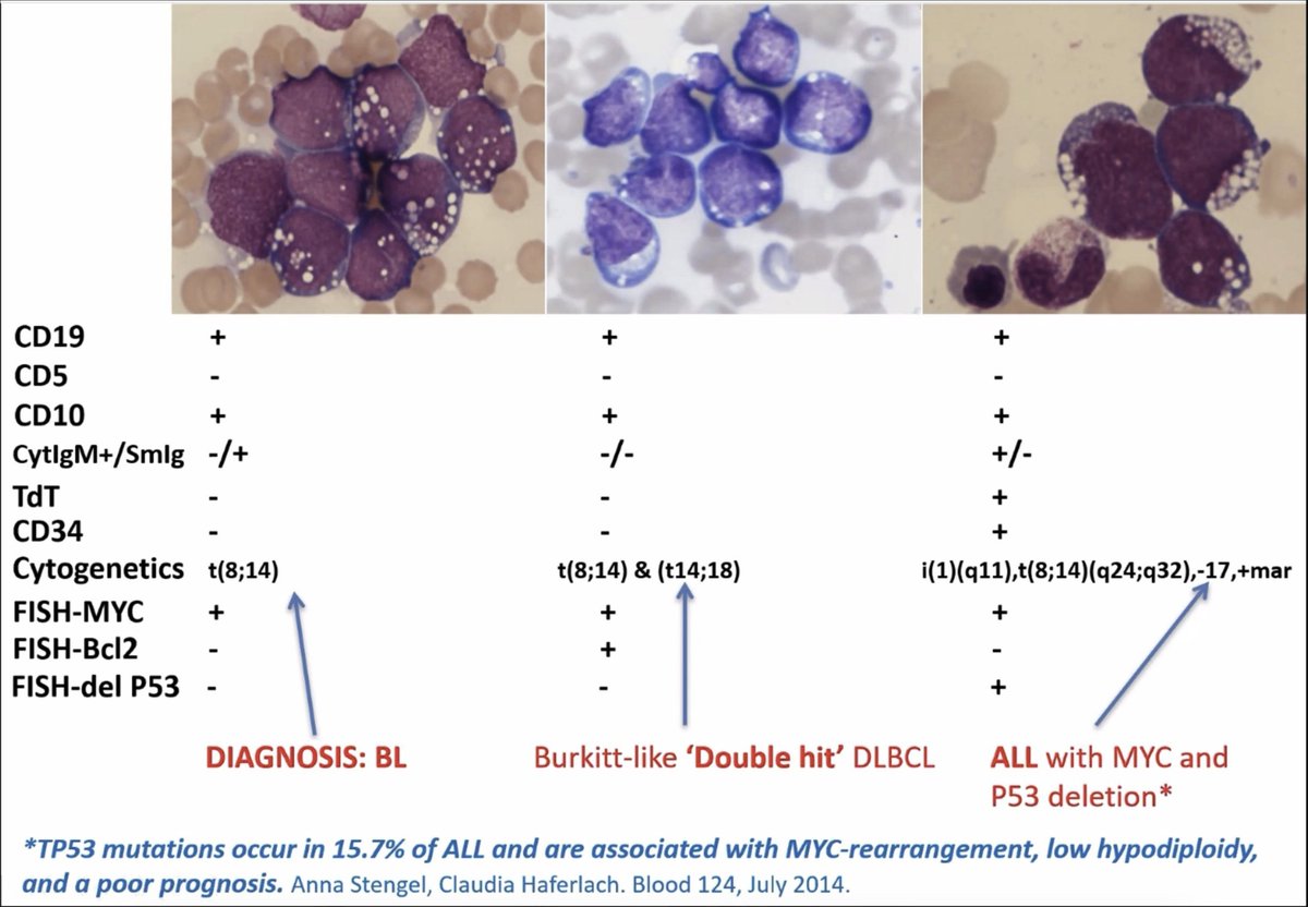 MorphologyAmigo's tweet photo. Haembyte

High Grade Lymphomas .......
How to tell them apart in a simple way....
May come in Handy for Upcoming FRCPath- You never know 😀
#medicine #medtwitter #meded #blooducation #hematology https://t.co/ypHsMXHTXT