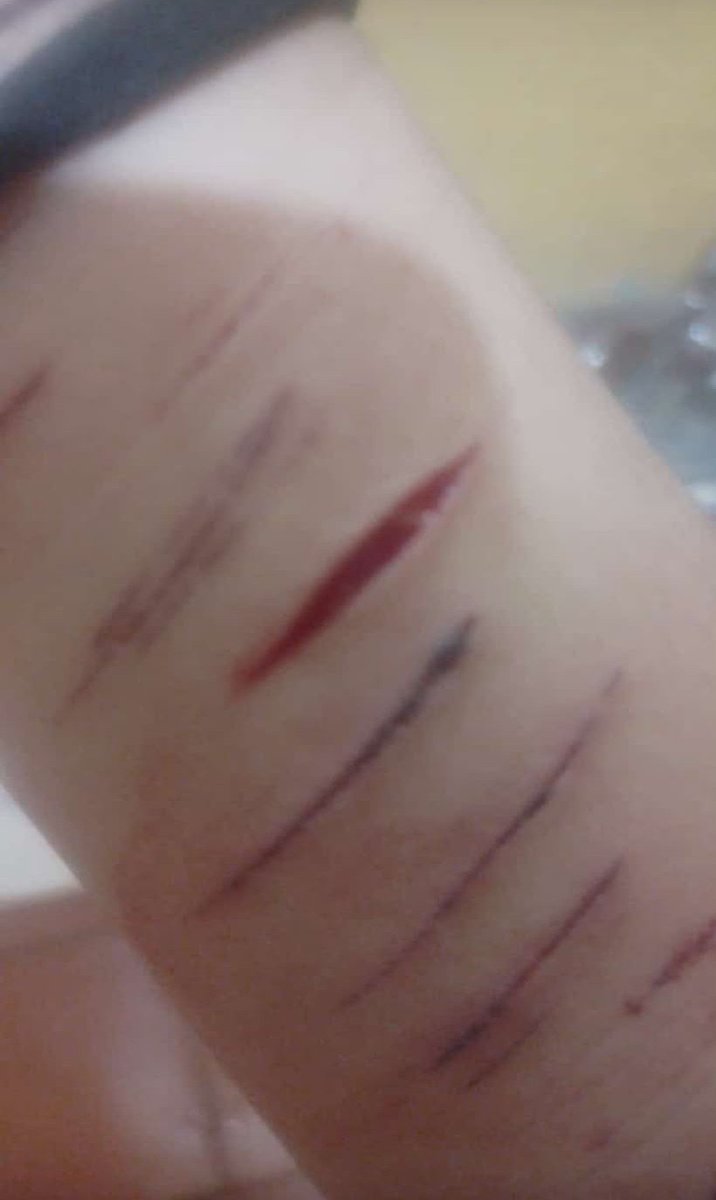 sleepysighs3's tweet photo. Old makeup, FAKKKKE, it’s fake, it’s makeup and fake blood (“old” makeup) #shtwtt https://t.co/bJR01G6pch