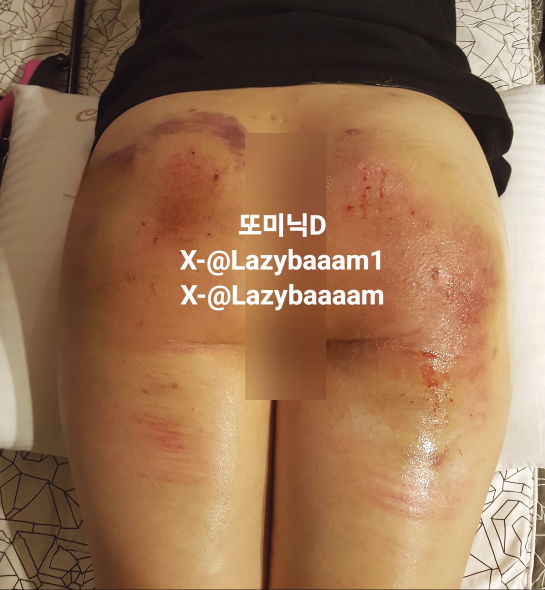 Lazybaaam1's tweet photo. 스팽 맛집 궁댕이
#maledom #femsub #sadist #spankee #spanker #prey #degradee #degrader #spanking #bbw #Lazybaaam1 #스팽 #스팽커 #스팽키 #디그레이더 #디그레이디 #멜돔 #멜커 #프레이 #팸섭 #팸키 #비떱 #에셈계 #에세머 #또미닉D https://t.co/YeXoWUO8OM
