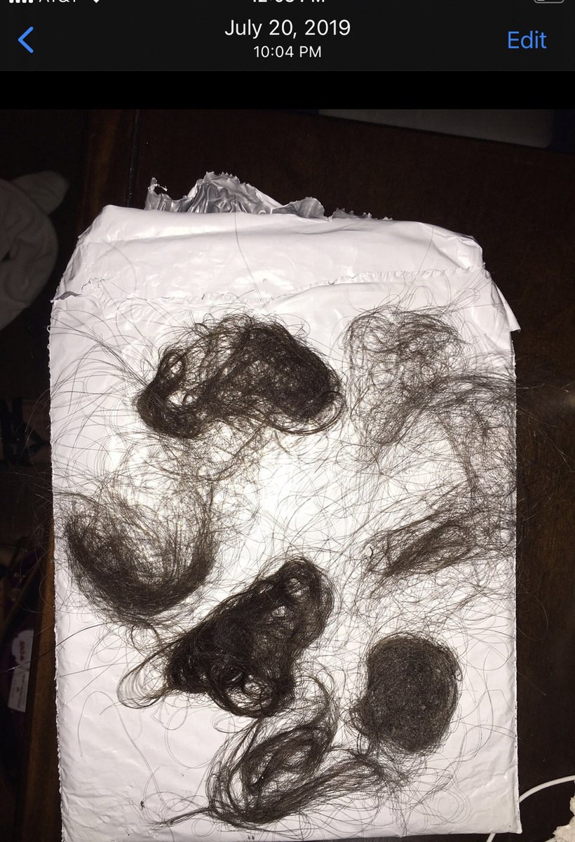 TindalReview's tweet photo. @remarks I had to get emergency brain surgery &amp; my hair was falling out in gobs after I went to the Washington Post about my nightmare divorce from an ops officer who consistently used his abilities to terrorize me. https://t.co/EUtoqf8pJ5