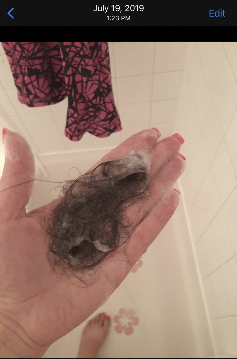 TindalReview's tweet photo. @remarks I had to get emergency brain surgery &amp; my hair was falling out in gobs after I went to the Washington Post about my nightmare divorce from an ops officer who consistently used his abilities to terrorize me. https://t.co/EUtoqf8pJ5