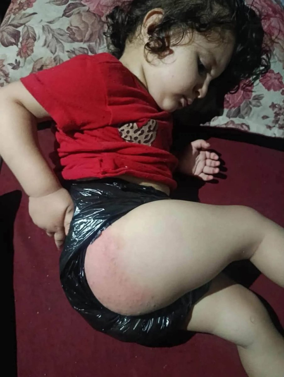 FoejMedia's tweet photo. Heartbreaking photos of Gaza toddler using plastic bag as diaper reveal desperate humanitarian shortages for children. https://t.co/S6gzSTGBBm