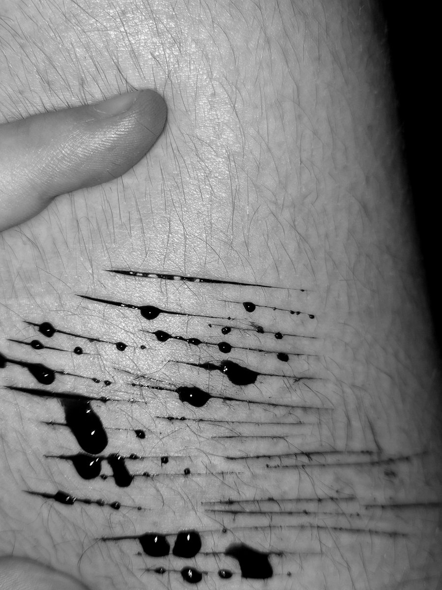 VoiidsDecay's tweet photo. relapsing after a few months https://t.co/A2rSecH8Gu