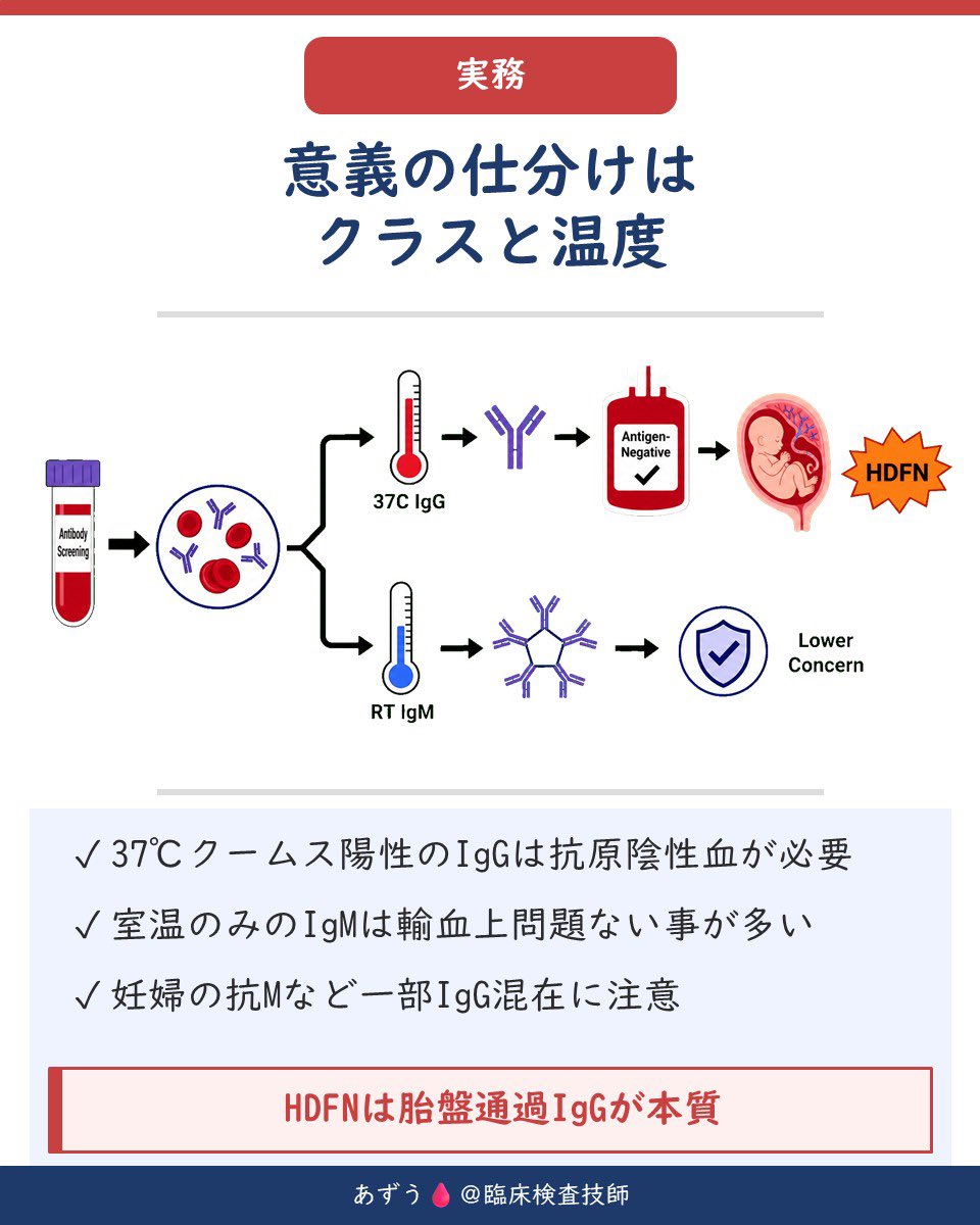 az_mt111's tweet photo. 🩸 免疫グロブリン5クラスの性格の違い──IgGとIgM、輸血で怖いのはどっち？

不規則抗体が陽性になったとき、
「この抗体、輸血して大丈夫ですか？」
と聞かれることがあります。

その判断のヒントになるのが、抗体のクラスと反応温度です🔬

免疫グロブリンには
IgG・IgM・IgA・IgD・IgEの5種類があります。

🔴 IgG
血清中で最も多い免疫グロブリン。単量体で比較的小さく、唯一胎盤を通過できます。輸血検査で重要なRh、Kidd、Kellなどの抗体の多くはIgG型です。

🔵 IgM
5つの免疫グロブリンが集まった五量体。非常に大きく、感染時に最初に作られる抗体でもあります。補体を活性化する力が強いのも特徴です。

🟢 IgA
唾液・鼻汁・母乳・腸液などに存在し、粘膜の防御を担当。

🟣 IgE
血中にはごくわずか。寄生虫防御やアレルギー反応に関係します。

⚪ IgD
血中には少なく、主にB細胞表面に存在します。

そして輸血検査で特に重要なのが、IgGとIgMの「見え方」の違いです。

IgMは分子が大きいため、赤血球同士を直接橋渡しできます。
👉 生理食塩液法でもそのまま凝集しやすい＝完全抗体

一方、IgGは小さいため、赤血球に結合してもそれだけでは凝集しにくい。
👉 間接抗グロブリン試験（間接クームス）で検出＝不完全抗体

ここで大切なのが、

⚠️ 「強く凝集する抗体ほど危険」とは限らない

ということ。

室温で派手に凝集するIgM主体の抗体でも、37℃で反応しなければ輸血上の臨床的意義が低いことがあります。

逆に、見た目の反応がそれほど派手でなくても、37℃で反応するIgG抗体は要注意。

遅発性溶血性輸血反応の原因になったり、胎盤を通過して胎児・新生児溶血性疾患（HDFN）を起こしたりする可能性があります🤰🩸

そのため抗体を評価するときは、

✅ IgGかIgMか
✅ 何℃で反応するか
✅ 生食法か間接クームス法か
✅ 37℃で反応する臨床的意義のある抗体か

をセットで考えることが重要です。

ただし、「IgM＝安全」と決めつけるのもNG。
たとえば抗MでもIgG成分を含み、37℃で反応するケースがあります。

🩸 反応の強さ＝危険度ではありません。

輸血で本当に警戒したいのは、
37℃で反応する臨床的意義のあるIgG抗体。

「何＋で凝集したか」だけでなく、
“どの温度・どの方法で反応したのか”を見る。

ここが不規則抗体を読むうえで大切なポイントです🔬