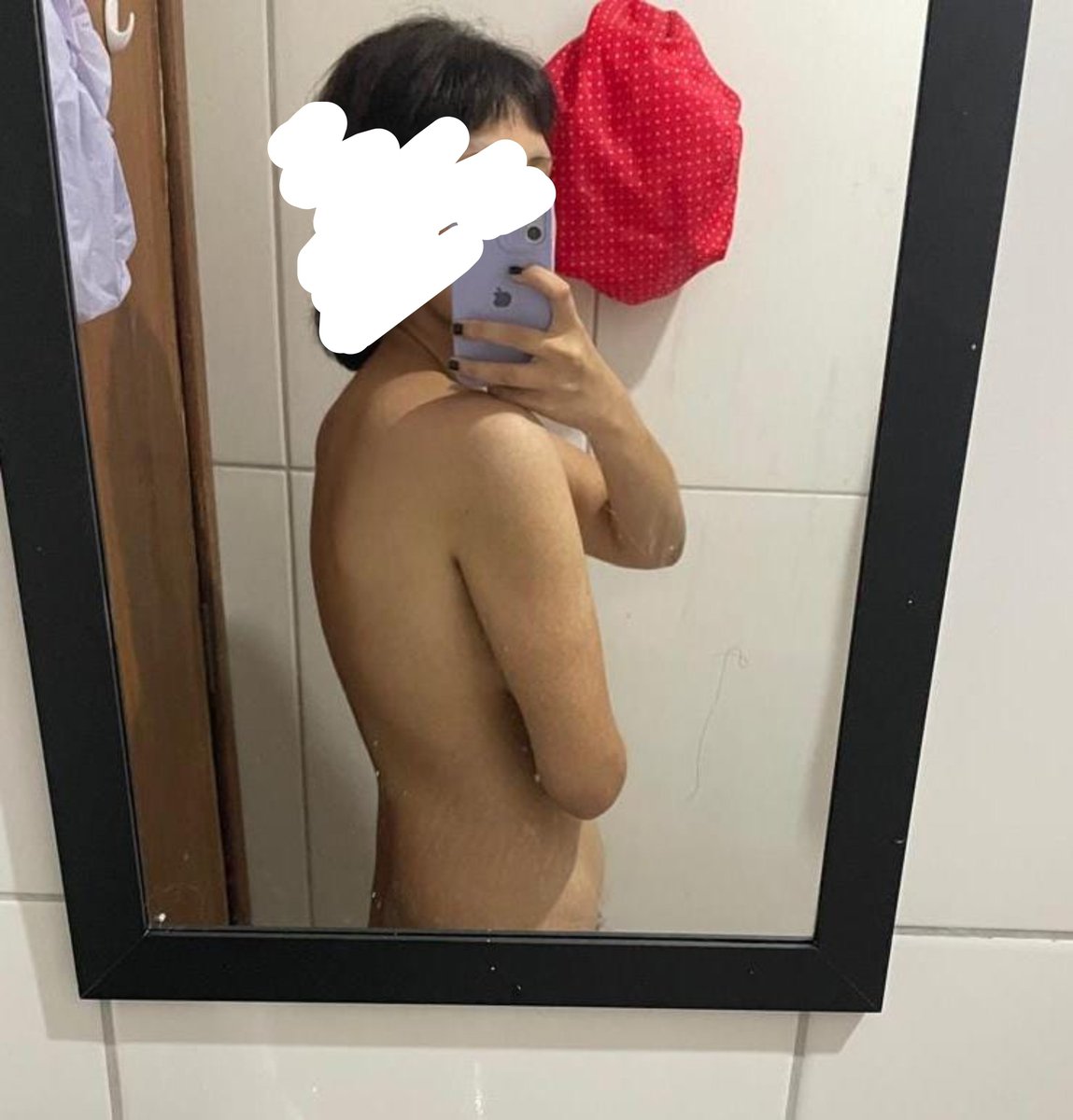 puke0cal's tweet photo. I took this first photo 5th october last year so 11 months difference https://t.co/Sx87K5o7Ge